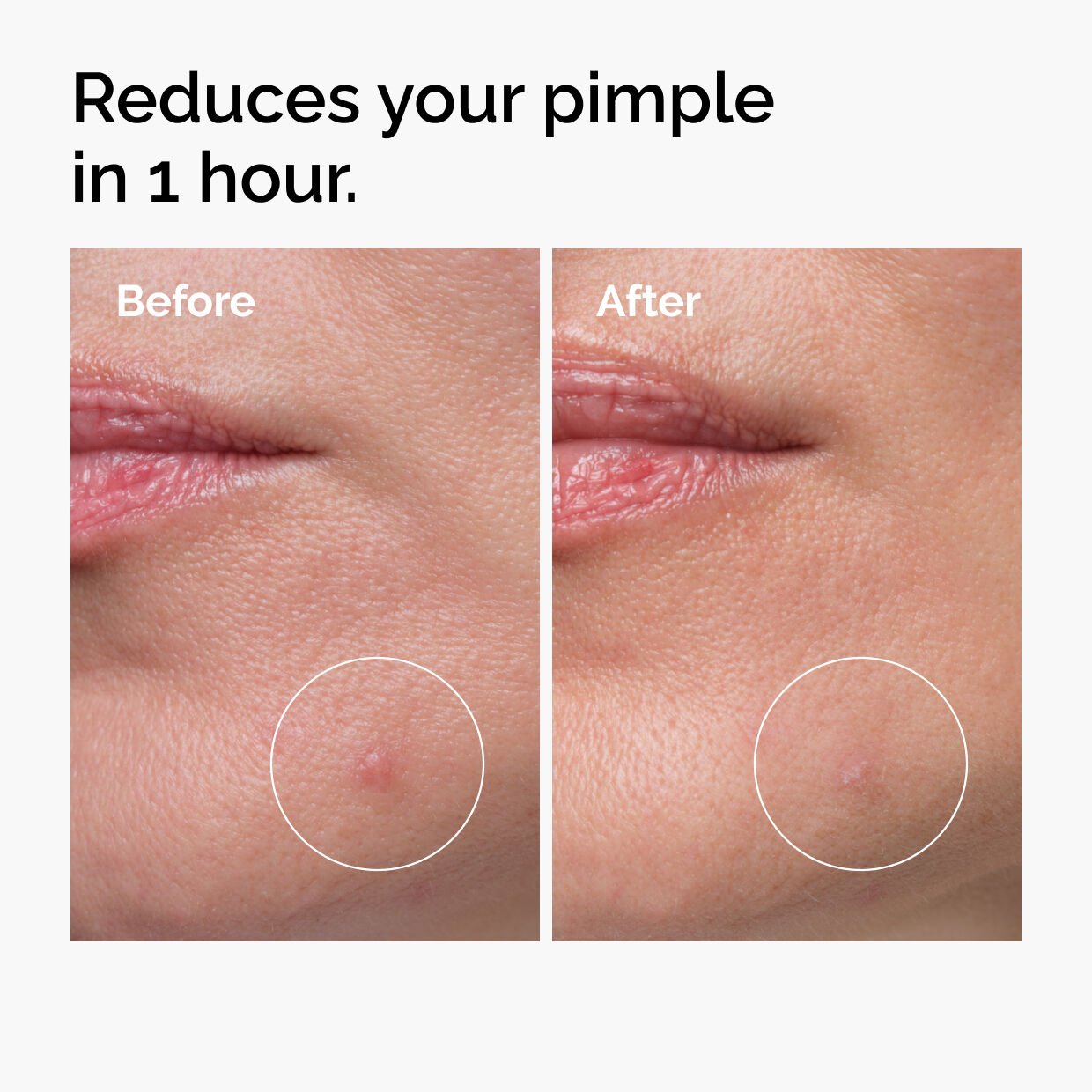 Sulfur 10% Powder to Cream Concentrate US5g - Image 3