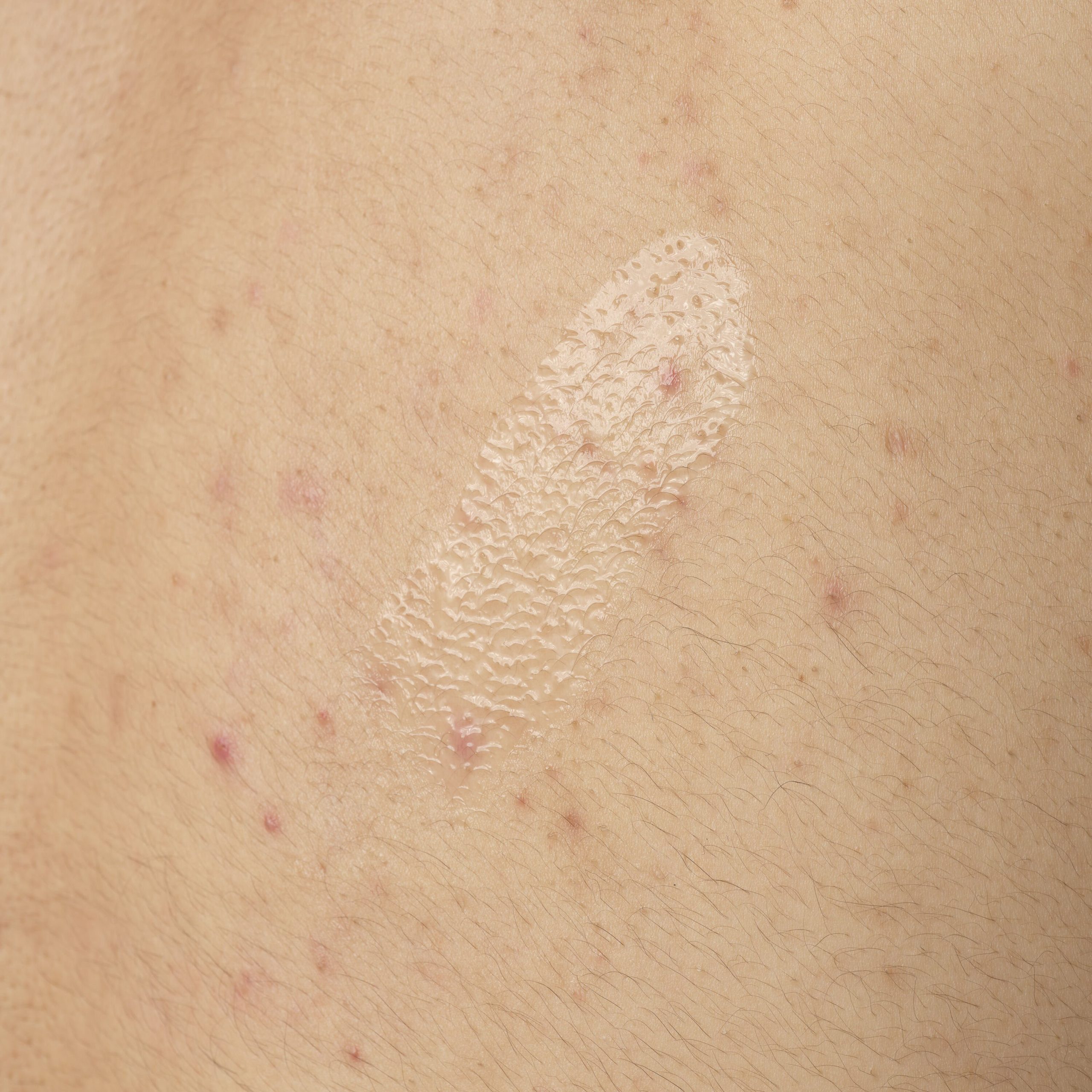 Salicylic Acid 0.5% Body Serum 240ml - Image 4